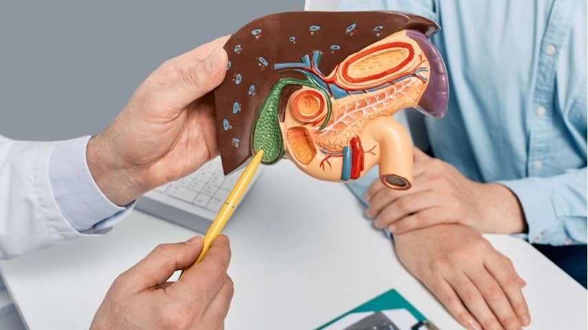 Gall Bladder Stones