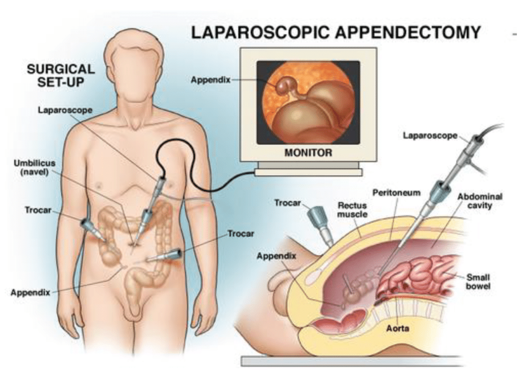Appendix