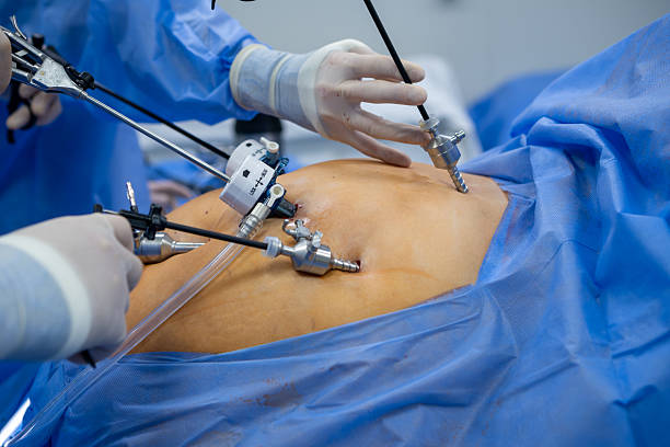Laparoscopic and minimally invasive surgery
