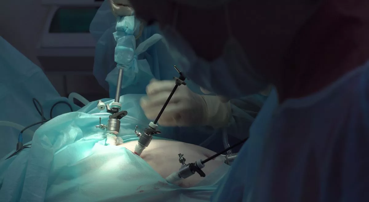 Laparoscopic Surgery